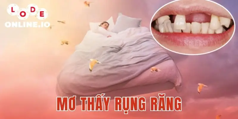 Mơ Thấy Rụng Răng
